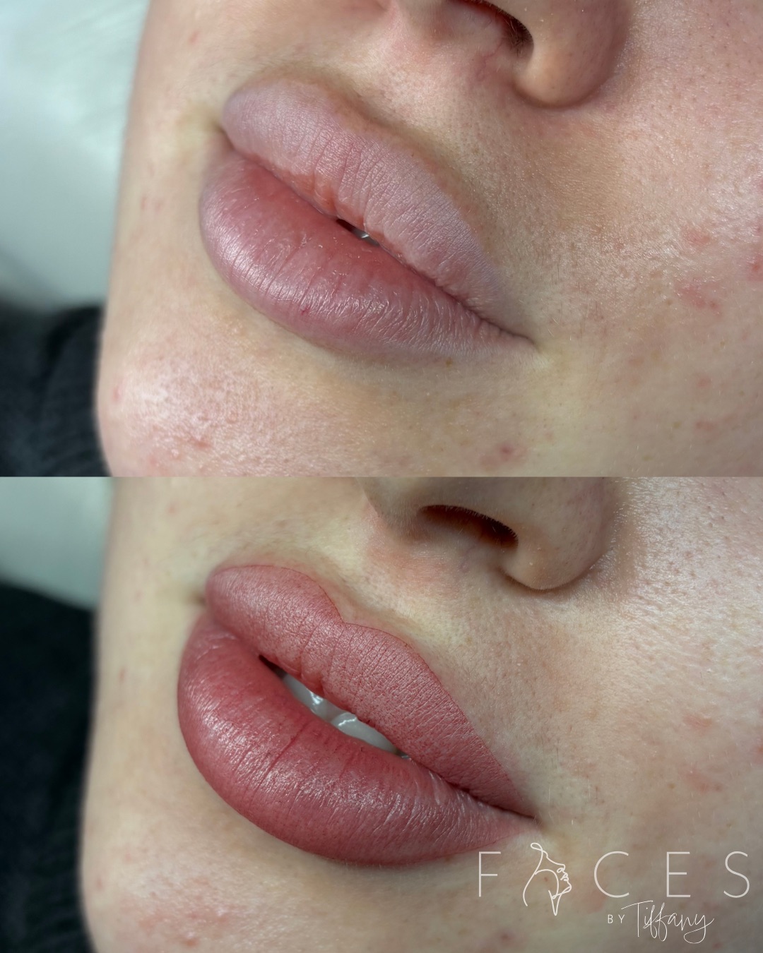 Before and after lip blush transformation showing natural to rosy pink lips