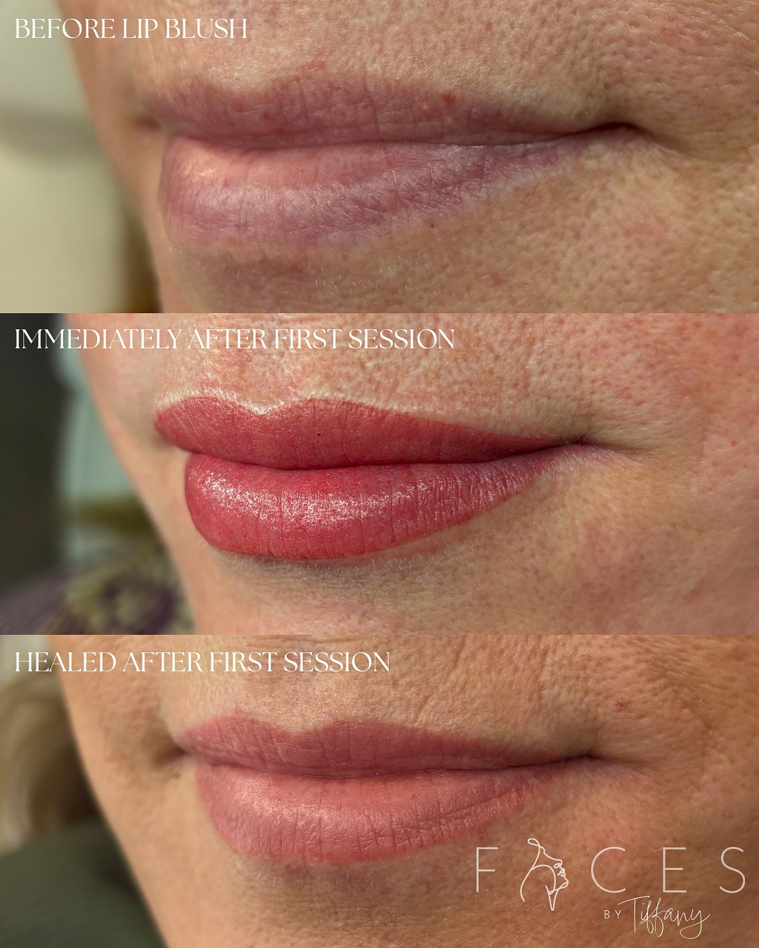 Lip blush healing progression showing before, immediately after, and healed results