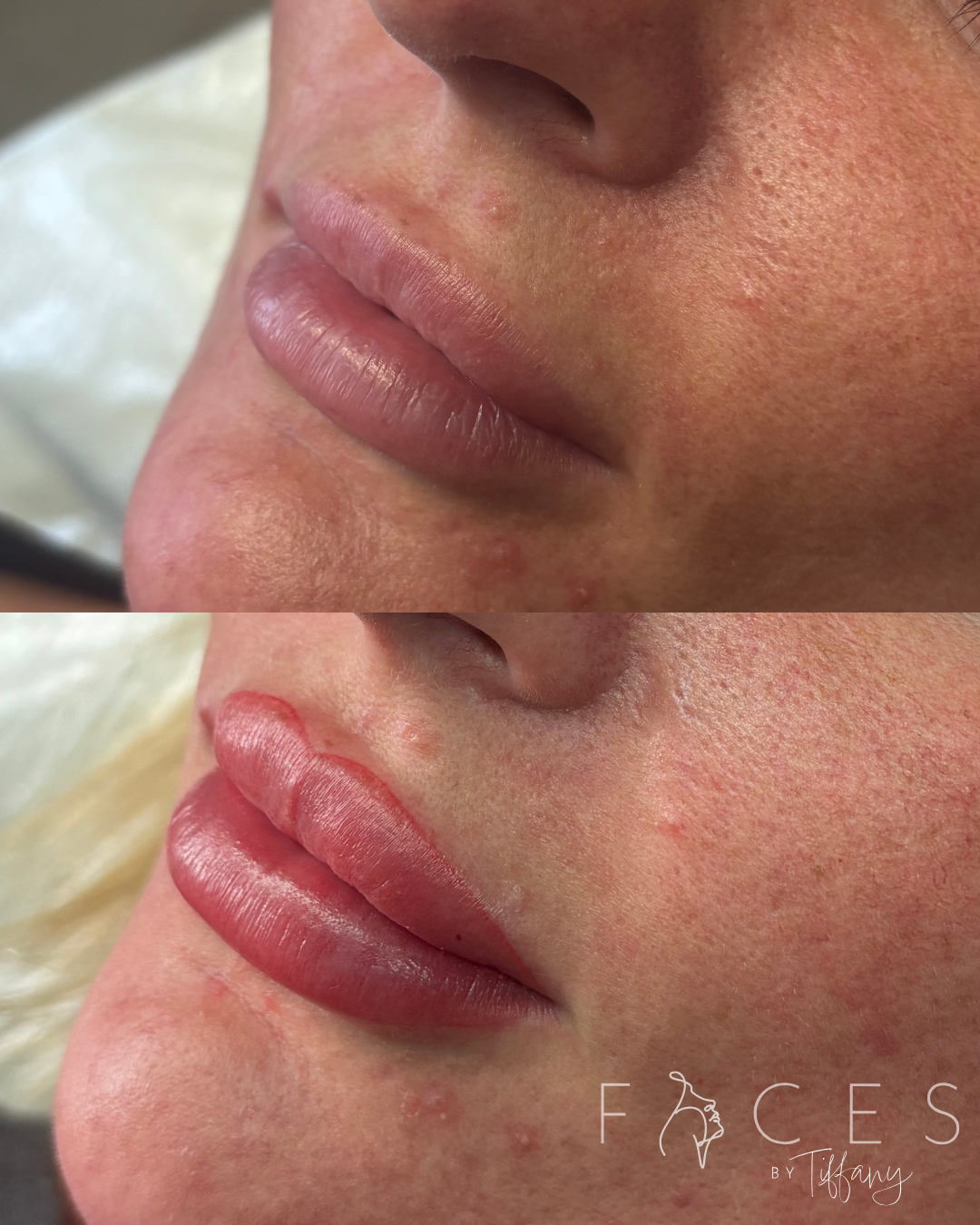 Before and after lip blush transformation showing natural to vibrant enhanced lips
